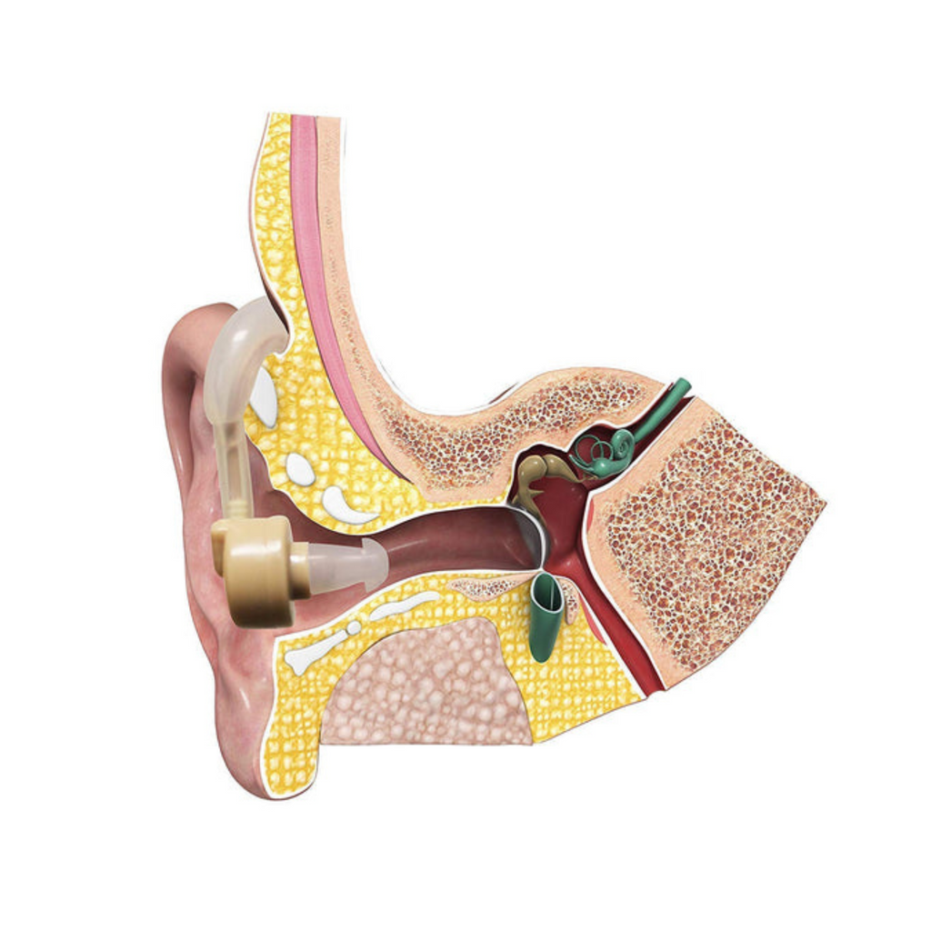 Behind-the-Ear Digital Hearing Aid